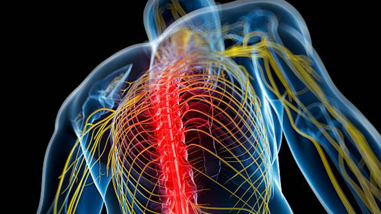 Identifying And Treating Pain From Nerve Tension Best Physiotherapist 