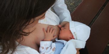 Breastfeeding and Jaundice
