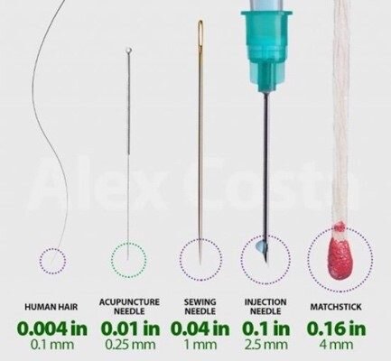 dry needling needle